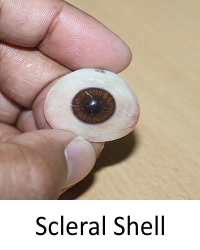 COSMETIC SCLERAL SHELLS
